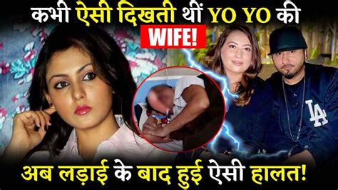 Yo Yo Honey Singh Wife Shalini Talwar How They Met And How A Beautiful Love Story Got
