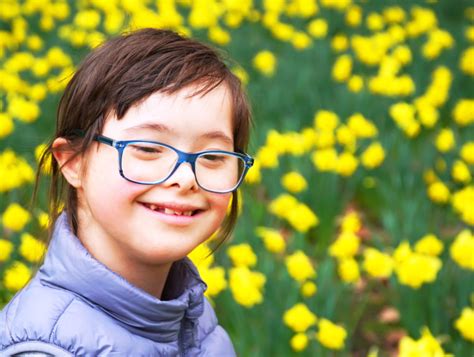 Down syndrome is named after dr. 10 Causes of Down Syndrome - Facty Health