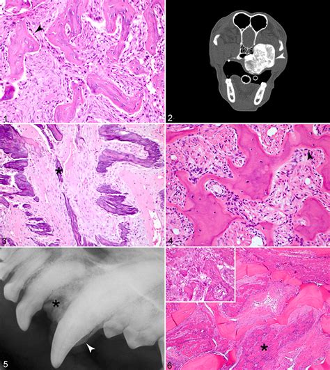Benign And Malignant Proliferative Fibro Osseous And Osseous Lesions Of