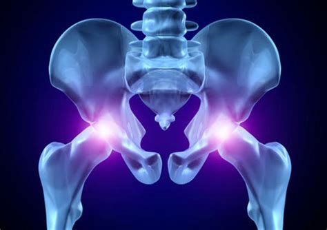 Hip And Groin Pain Manchester Hip Clinic