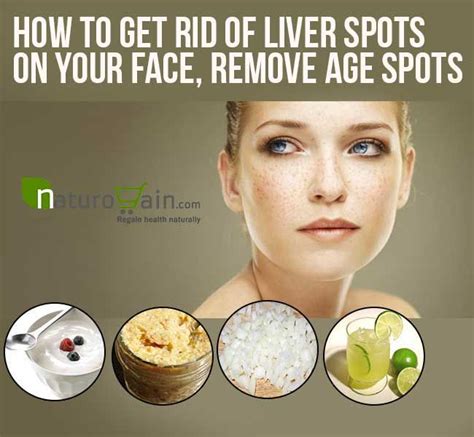 How To Get Rid Of Liver Spots On Your Face Fast Age Spot Removal