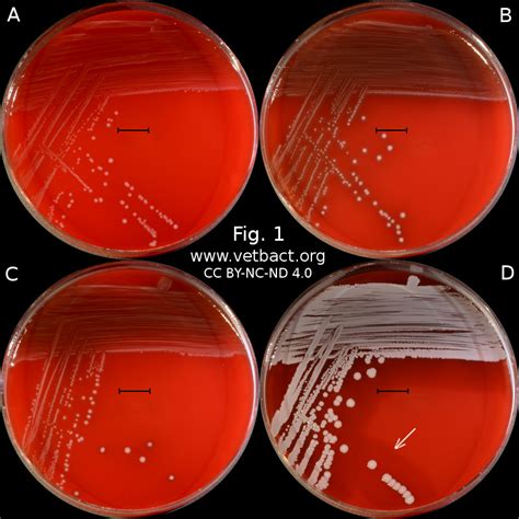 Hemolysis On Blood Agar Plate Cloudshareinfo