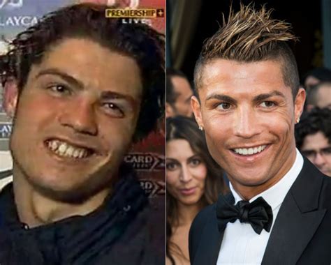 Antes Y Despues De Cristiano Ronaldo Kulturaupice