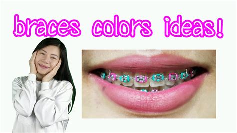 Braces Colors Combinations