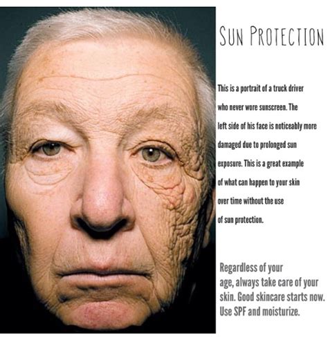 Sun Is Never Good For The Skin Fairest Of Them All