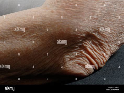 Skin Age Old Person Wrinkles Tears Folds Wrinkles Hand Elbow