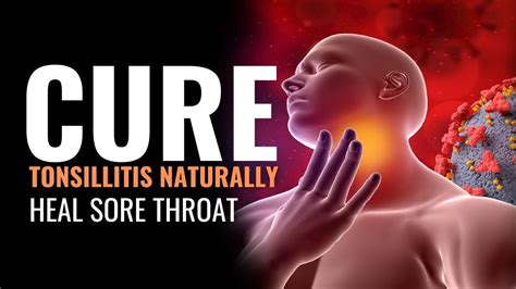 Tonsillitis Treatment Frequency To Heal Sore Throat Cure