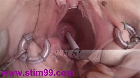 Extreme Real Cervix Fucking Insertion Objects In Utherus Xhamster