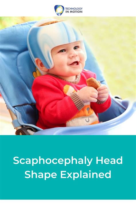 Scaphocephaly Head Shape Explained Baby Head Shape Head Shapes