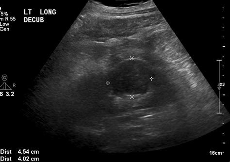 Body Imaging Kidney International Contrast Ultrasound Society