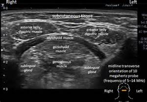 Submandibular Gland Ultrasound