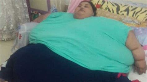 Worlds Heaviest Woman Smiling Again After Surgery