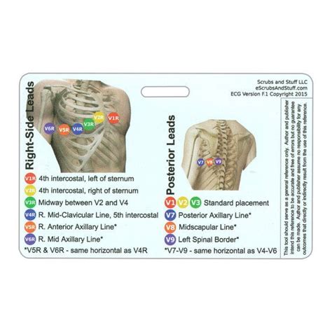 Ekg 12 Lead Placement Horizontal Badge Card By