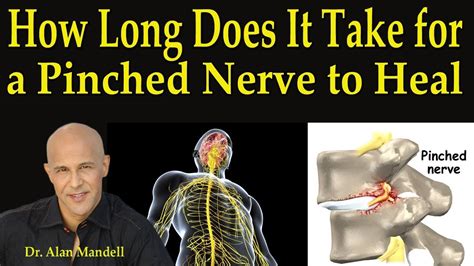Review Of Pinched Nerve In Neck And Shoulder Treatment At Home References