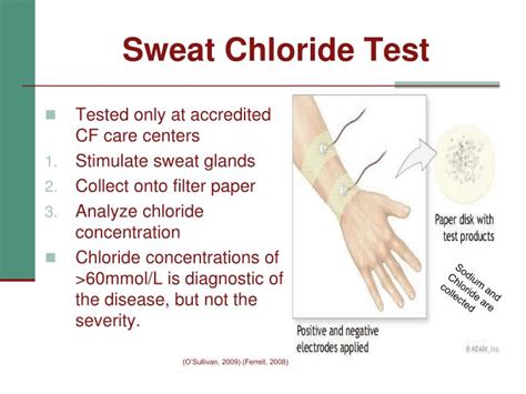Ppt Cystic Fibrosis Powerpoint Presentation Id4201102