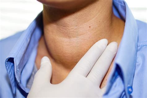 Recurrence Of Thyroid Cancer And Treatment Options Cancer Medical