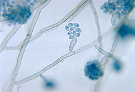 To know more about fungal hyphae, do all fungi have hyphae? Details - Public Health Image Library(PHIL)