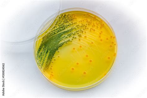 Vibrio Choleraegram Negative Comma Shaped Bacterium Stock Photo