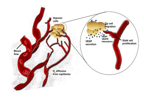 Researchers Show How Blood Vessels Regroup After Stroke