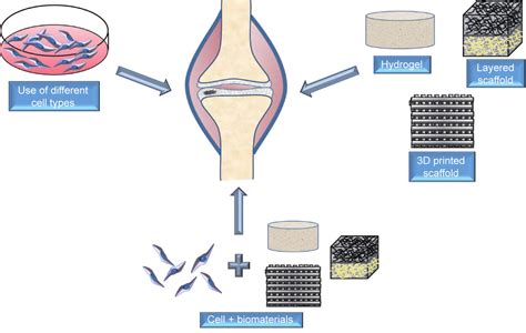 Regenerative Engineering For Knee Osteoarthritis Treatment