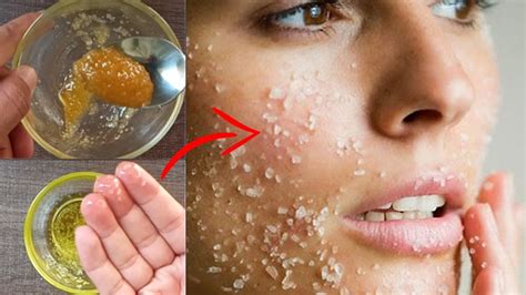 How To Remove Dead Skin Naturally Best Home Remedies To Remove Dead