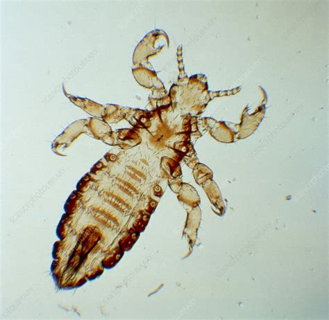 LM Of Human Head Body Louse Stock Image Z265 0023 Science Photo