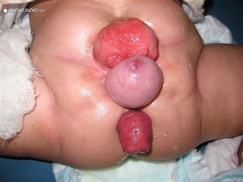 Fucking Her Prolapsed Cervix