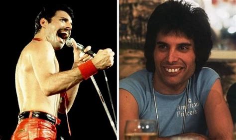 Freddie Mercury Teeth Xray The Curious Case Of Freddie Mercury S