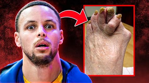 NBA Players With The NASTIEST FEET Revision YouTube