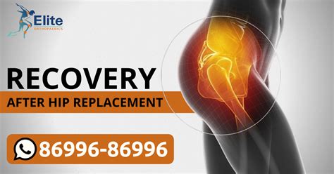 Recovery Hip Replacement Drmanuj Wadhwa Best Hip Replacement