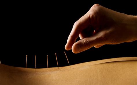 5 Benefits Of Acupuncture Back To Wellness