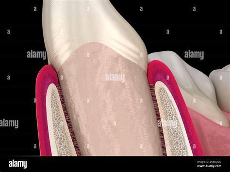 Morphology Of Maxillary Lateral Incisor Tooth And Gum Medically