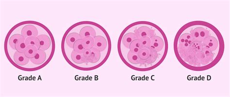 Classification Criteria And Categories According To The Embryo Quality