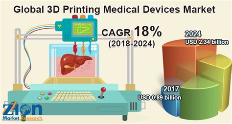 Which Are The Major Players Leveraging The Global 3d Printing Medical