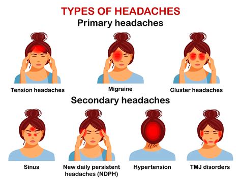 Headaches A Short Guide From Emed