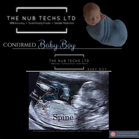 Confirmed Nub Theory The Nub Techs Nub Theory Early Gender Prediction