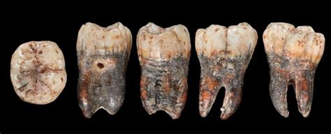 Long Lost Neanderthal Tooth Reveals A Surprising Unknown Link To Modern