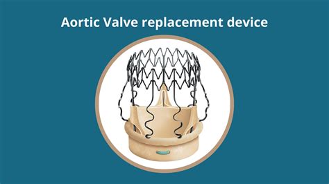 Sutureless Aortic Valve Replacement Rbandhh Specialist Care
