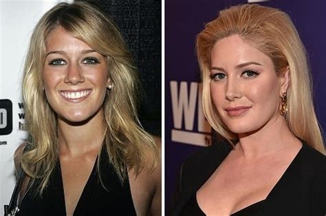 Heidi Montag Plastic Surgery Transformations Before And After Pictures Glamour Path