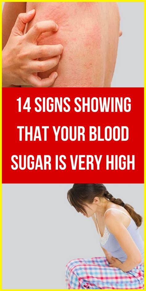 Signs Of High Blood Sugar Level That Everyone Ignores Wellness Today
