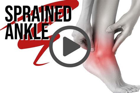 Psandj Icourse Sprained Ankle Phoenix Spine And Joint