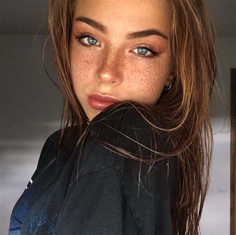 Freckles R Prettygirls