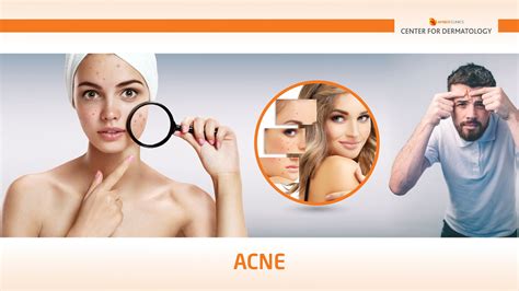 Acne Amber Clinics