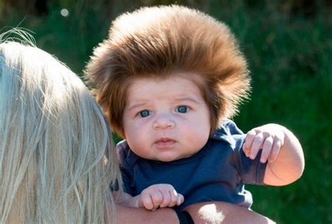 bebê mais cabeludo do mundo está conquistando os internautas jornal do estado ms