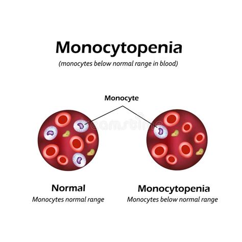 Differentiation Of Monocytes Stock Vector Illustration Of