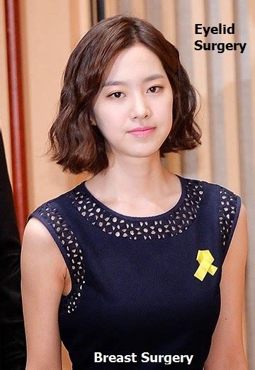 Jin Se Yeon Plastic Surgery Before And After Plastic Surgery Photos