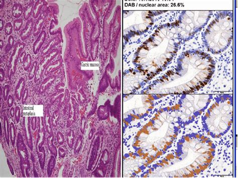 Gastric Glands Histology