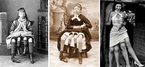 Josephine myrtle corbin was an american sideshow performer born as a dipygus. Οι μεγάλες ατραξιόν των freak shows του παρελθόντος ...