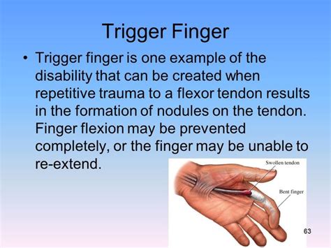 Pin On Trigger Finger