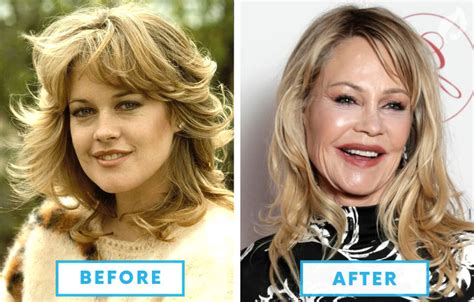 Top 10 Celebrities With The Worst Plastic Surgery Watchmojo Com